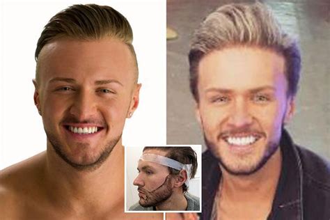 kyle geordie shore before and after